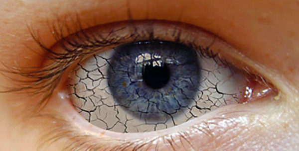 ojo-seco-oftalmologia-marbella
